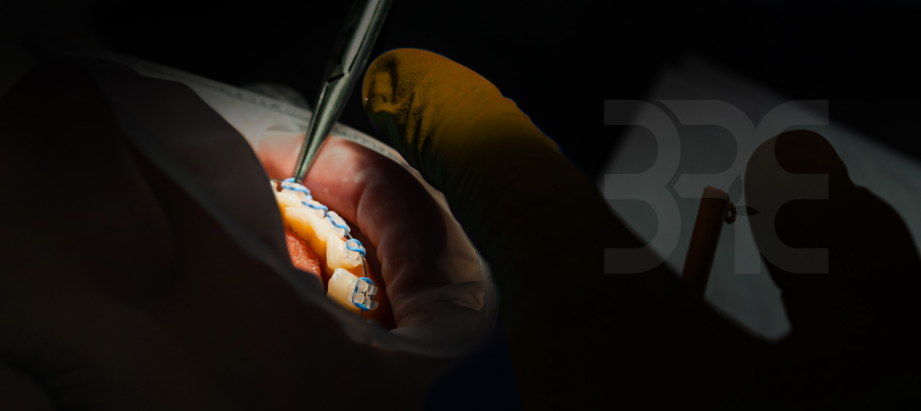 당신을 위한 교정치료