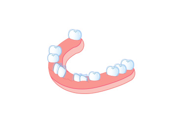 이가 나지 않는 경우