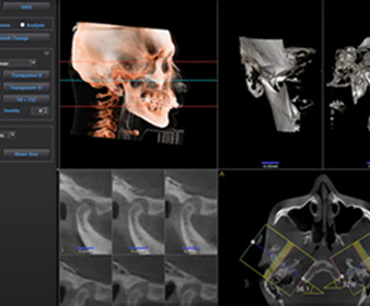전체 골격 분석